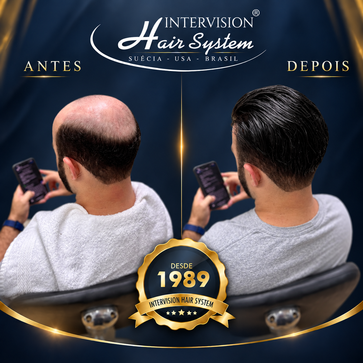 Antes e depois de prótese capilar - resultado real Intervision Hair System em Brasília 02
