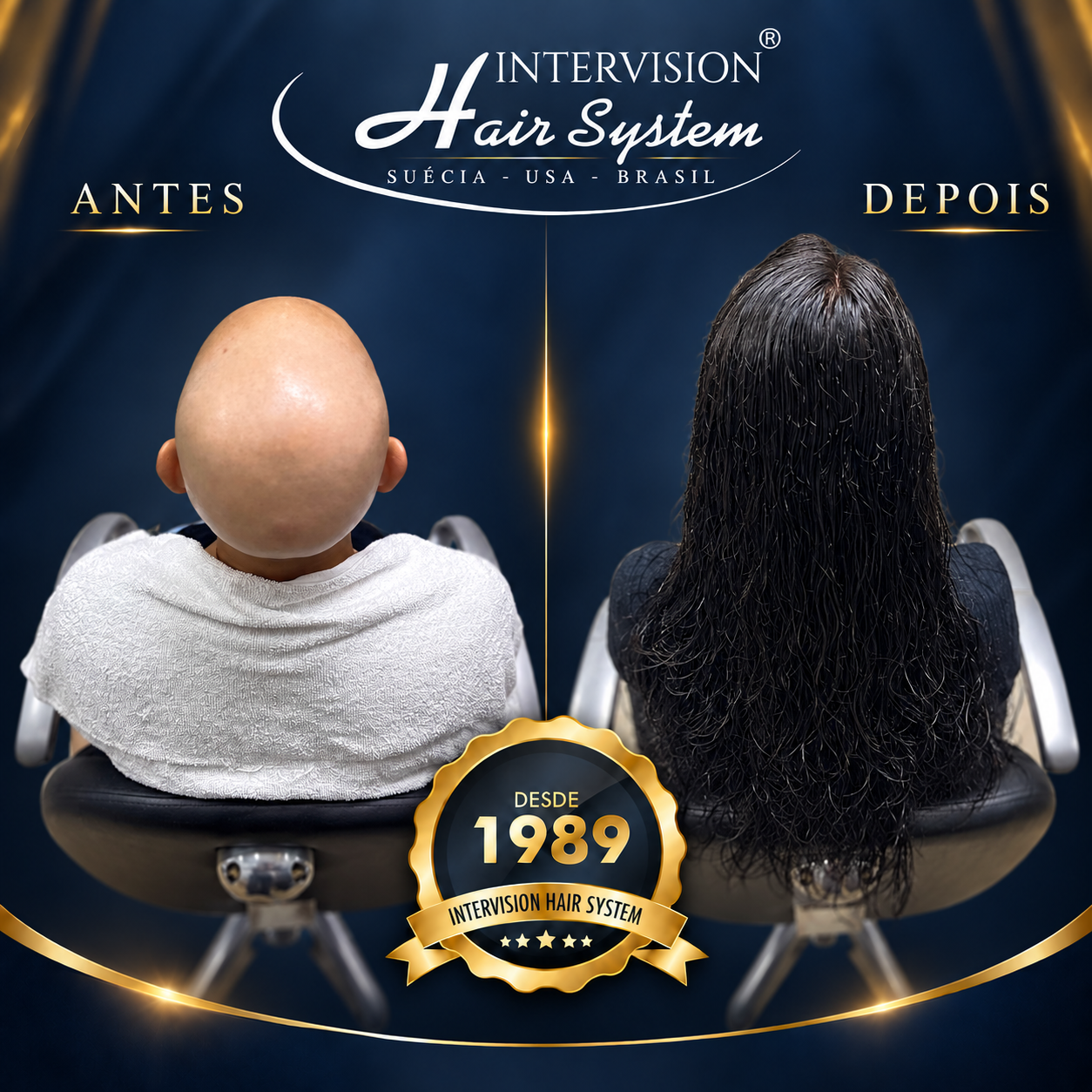 Antes e depois de prótese capilar - resultado real Intervision Hair System em Brasília 05