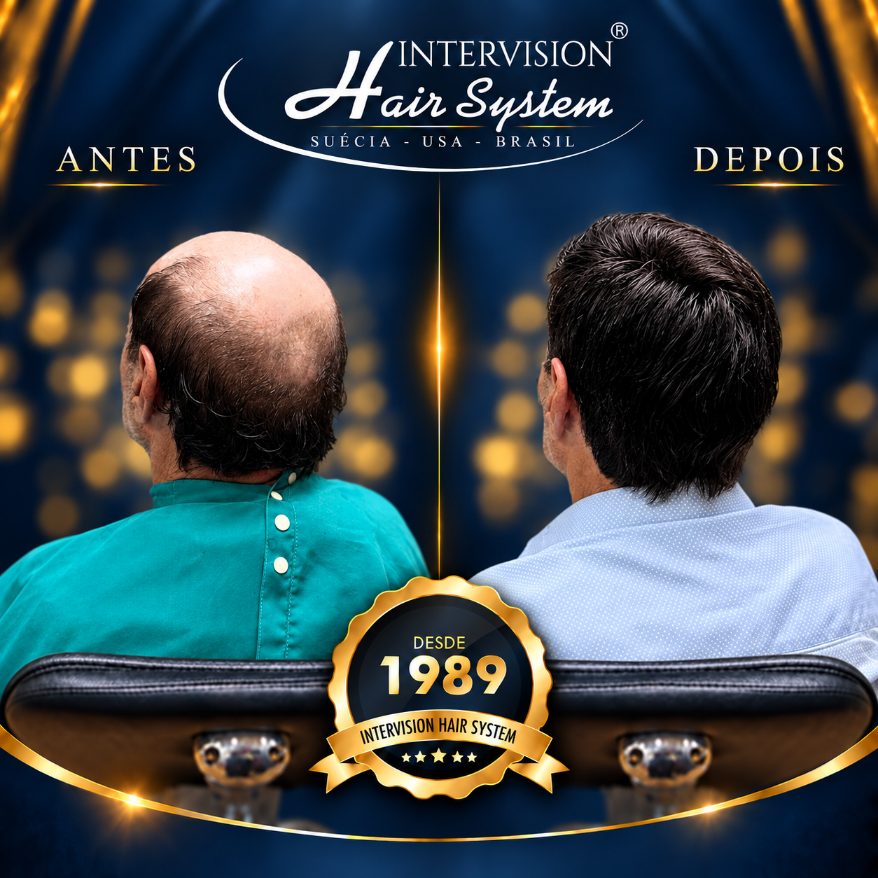 Antes e depois de prótese capilar - resultado real Intervision Hair System em Brasília 11
