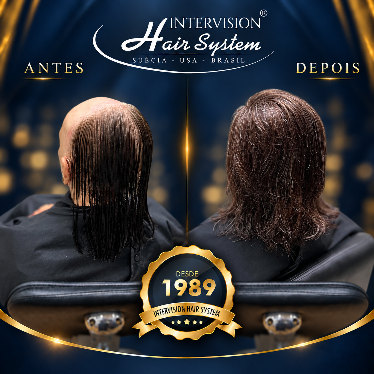 Antes e depois de prótese capilar - resultado real Intervision Hair System em Brasília 16